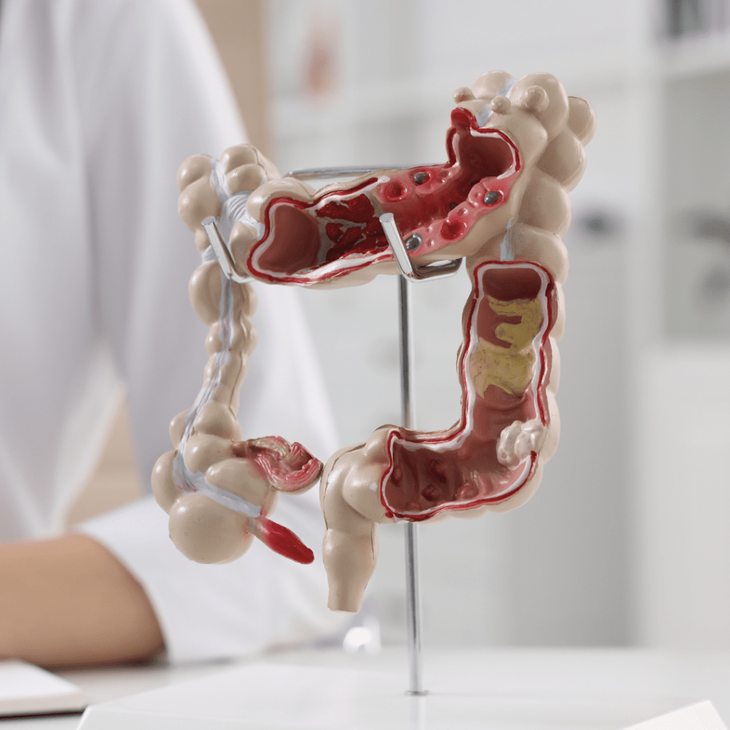 Modulação Intestinal